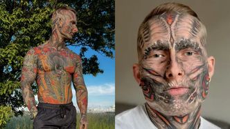 Pokrył tatuażami całe ciało, teraz relacjonuje proces ich USUWANIA. Różnicę widać gołym okiem: "Oto efekty po ROKU" (FOTO)