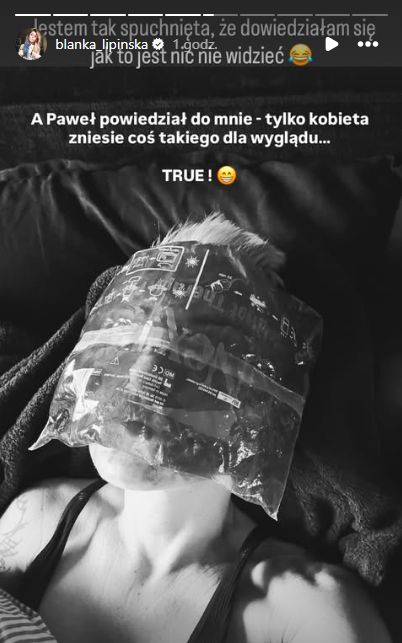 Blanka Lipińska poddała się kolejnemu zabiegowi