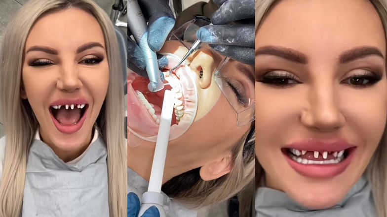 Magdalena Lubacz chwali się zakładaniem koron