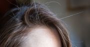 Na głowie pojawiły się siwe nitki? Wypróbuj patent Japonek