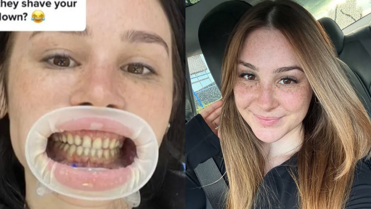 Zrobiła sobie "tureckie zęby". Nie wszyscy są przekonani