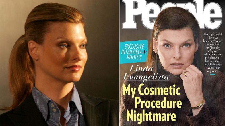 Linda Evangelista pokazała nowe zdjęcie zdeformowanego po zabiegu ciała