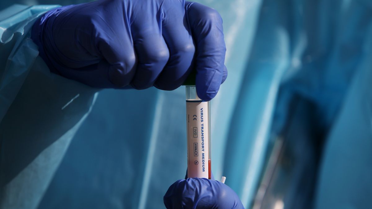 SensDX wprowadza szybkie testy na COVID-19