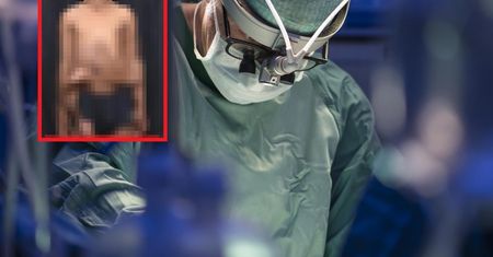 Miał dodatkową parę nóg. Wyrastały z jego brzucha