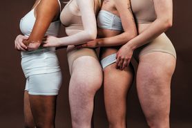 Body shaming – przykłady, przyczyny i skutki