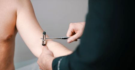 Objaw Chvostka i tężyczka – przyczyny, objawy i leczenie