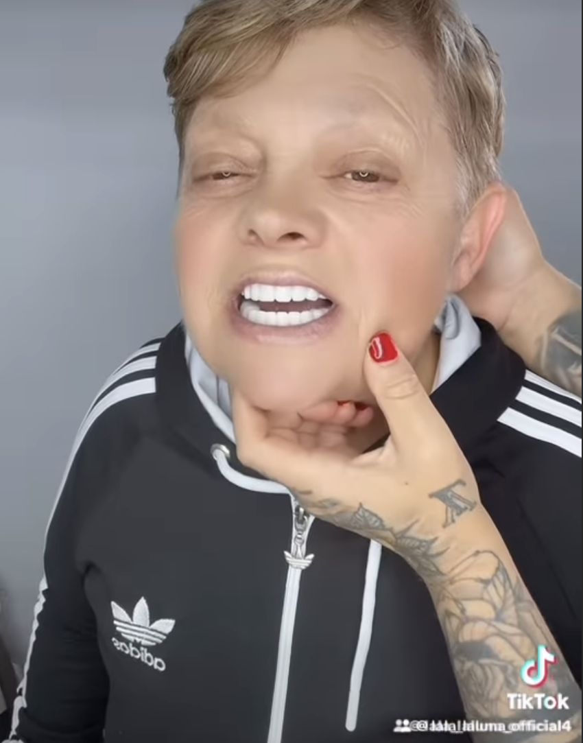 Mama Laluny pochwaliła się tureckim uzębieniem