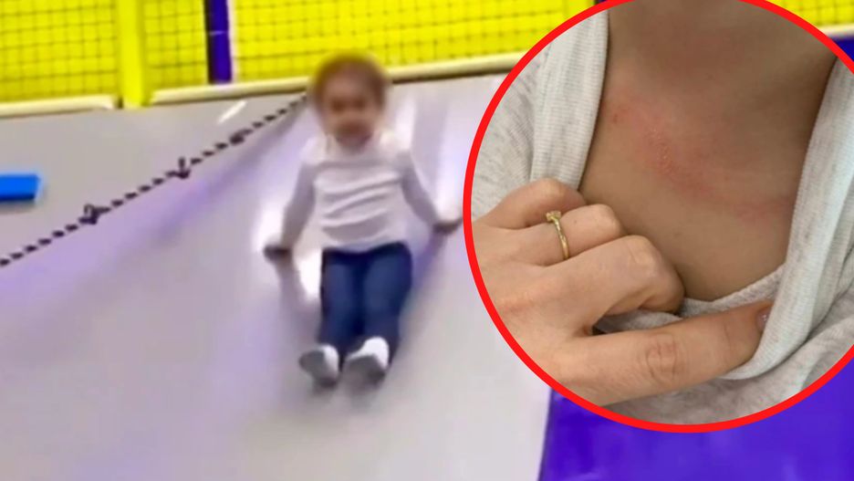 O włos od tragedii w parku rozrywki. Trzylatce lina zadzierzgnęła się wokół szyi