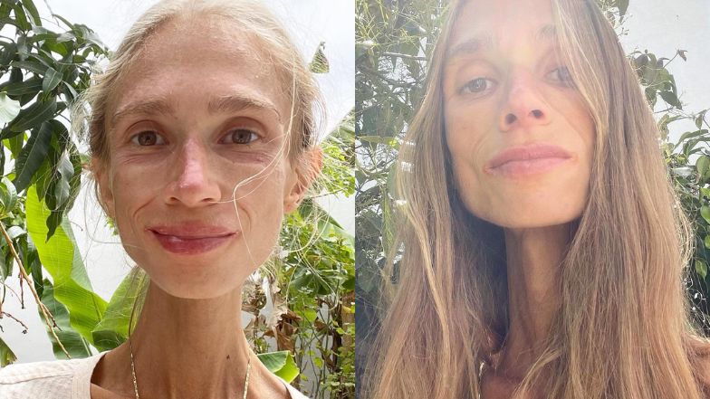 Karolina Krzyżak zmarła na Bali. Ważyła 27 kilogramów. "Nie chciała mieć do czynienia z lekarzami"