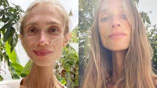 Karolina Krzyżak zmarła na Bali. Ważyła 27 kilogramów. "Nie chciała mieć do czynienia z lekarzami"
