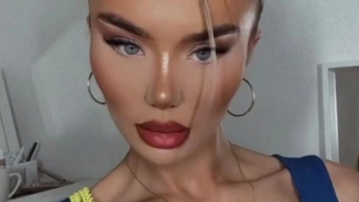 Maisy Edwards wyjechała niedawno do Turcji, aby przejść drugą operację plastyczną nosa