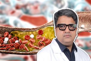 Tak obliczysz wskaźnik cholesterolu. "Może pokazać, czy dana osoba jest zagrożona"