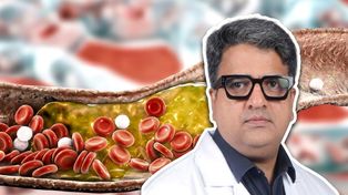 Tak obliczysz wskaźnik cholesterolu. "Może pokazać, czy dana osoba jest zagrożona"