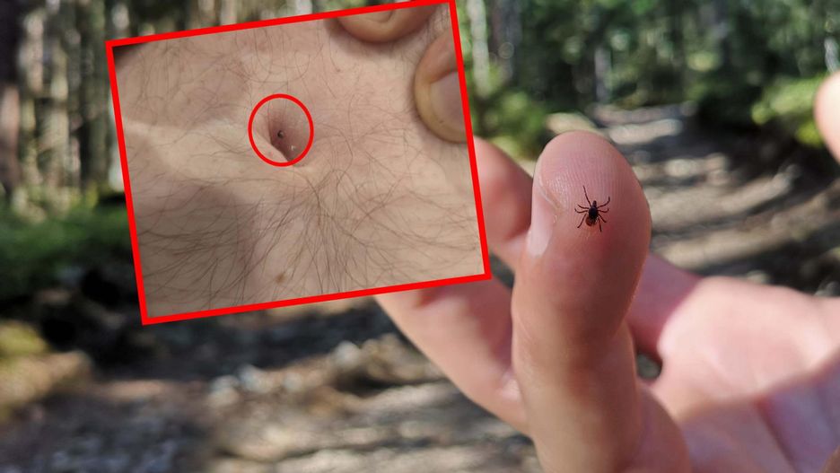 Ostrzega przed kleszczami