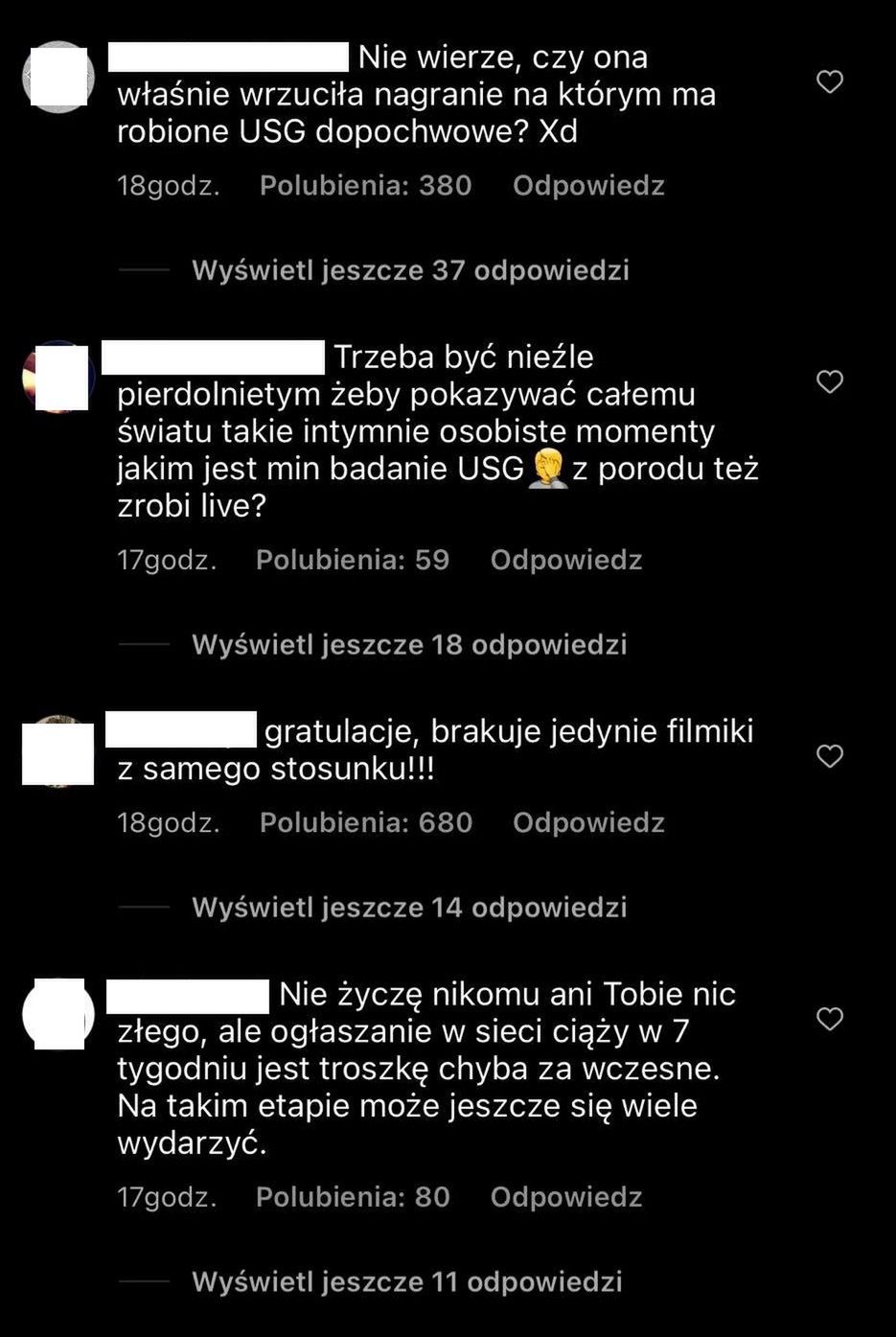 Lil Masti relacjonuje badanie USG u Mamy Ginekolog