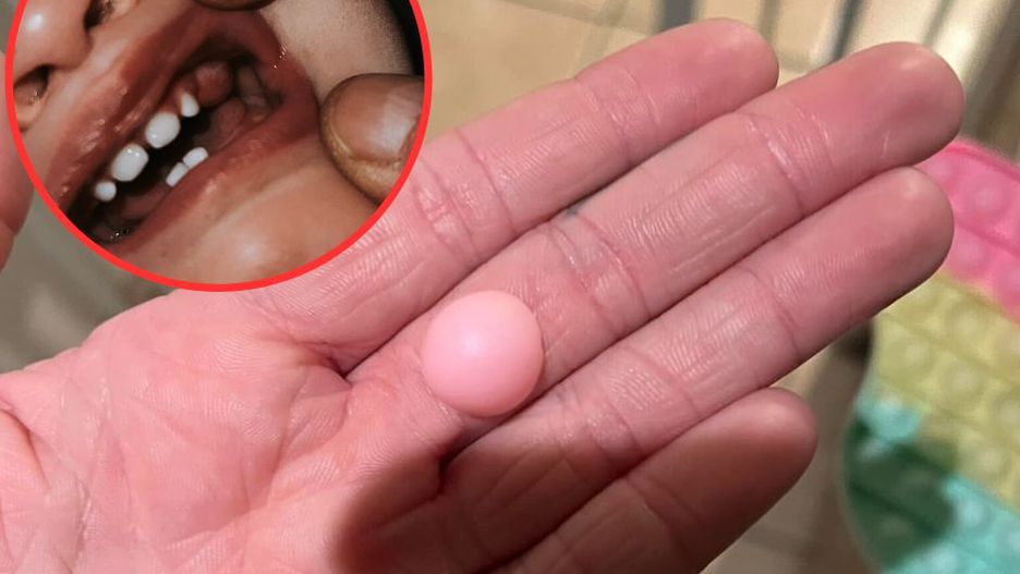 Chłopiec mógł umrzeć przez popularną zabawkę. Wielu z nas ma ją w domu