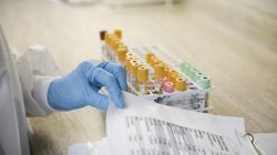 Nie tylko cholesterol. To badanie powinien zrobić każdy