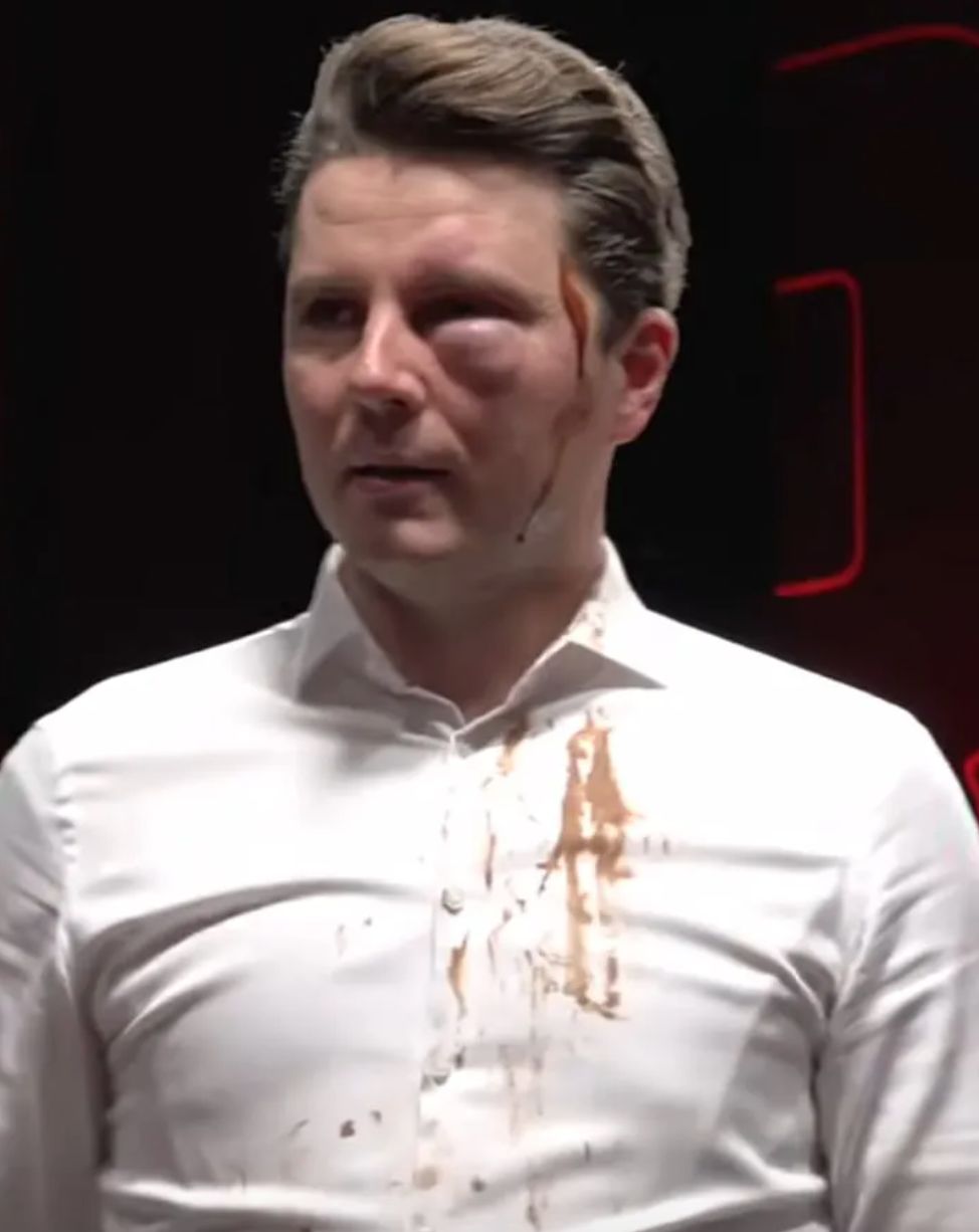 Piotr Korczarowski skończył z OGROMNYM SINIAKIEM