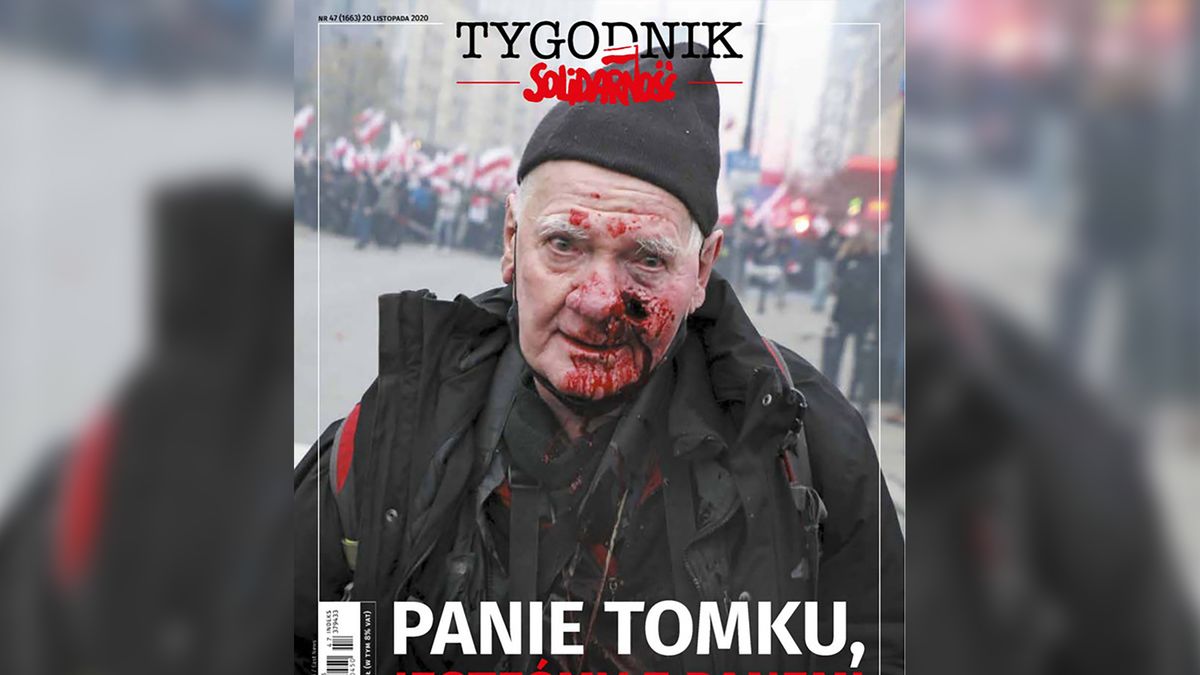 Tomasz Gutry kontra policja. Raniony fotoreporter będzie żądał odszkodowania 1