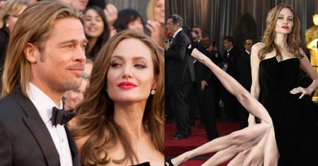 "Angelina nie interesowała się swoją nogą"