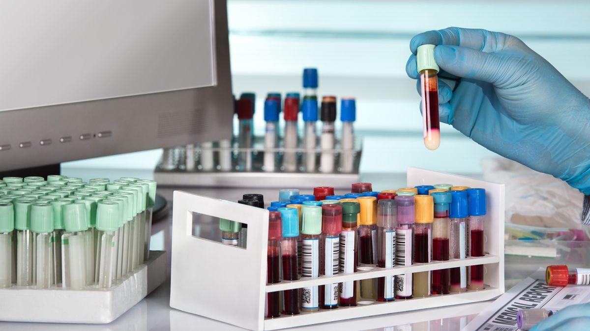 Ciężki skojarzony niedobór odporności (SCID) rozpoznaje się zaczynając m.in. od oceny liczby limfocytów we krwi