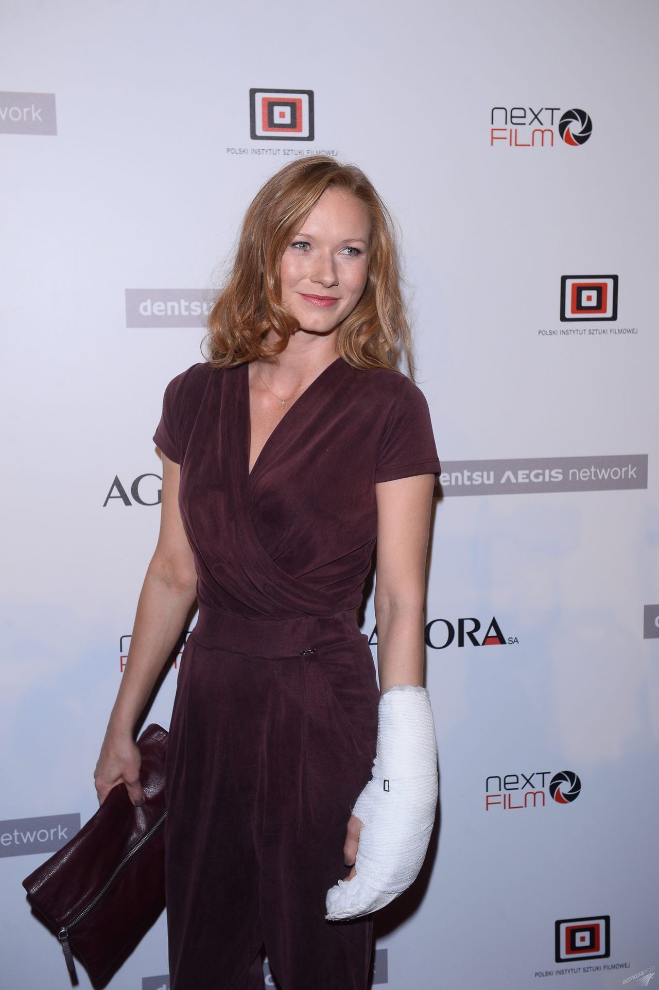 Katarzyna Dąbrowska ze złamana ręką na premierze "Król życia"