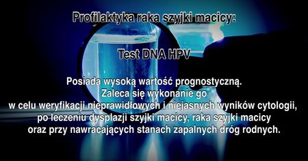 Wszystko, co trzeba wiedzieć o raku szyjki macicy