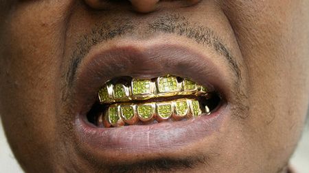 Złoty ząb zablokował kulę 1