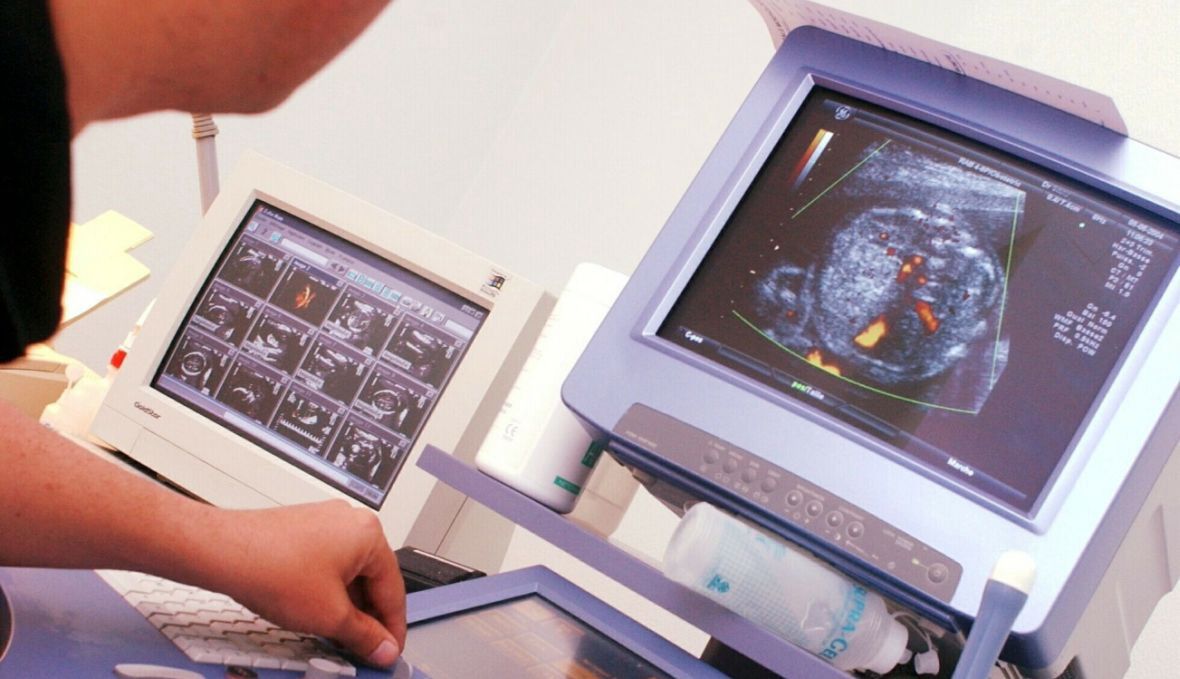 Zdjęcia z USG, wpisy w karcie ciąży, wyniki badań i paragony surogatka, z którą rozmawiałam, woli przesyłać na maila albo telefon. Nie chce, aby doszło do nawiązania więzi pomiędzy nami