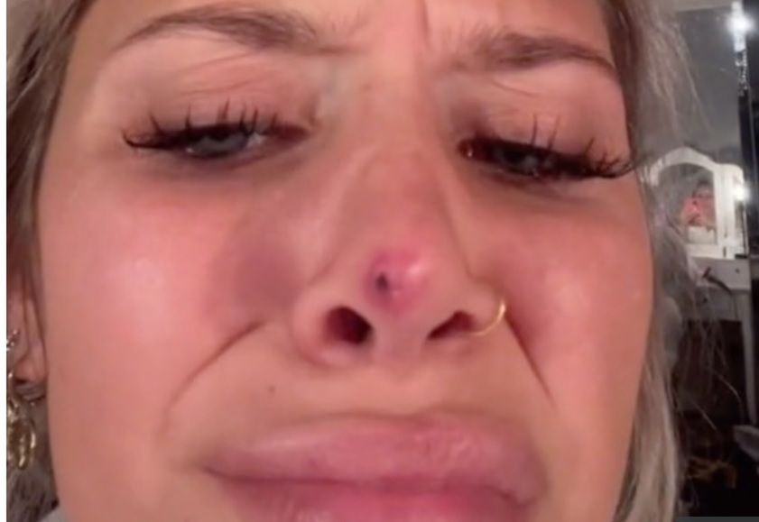 Chciała poprawić wygląd nosa. Na czubku pojawiła się czerwona plama