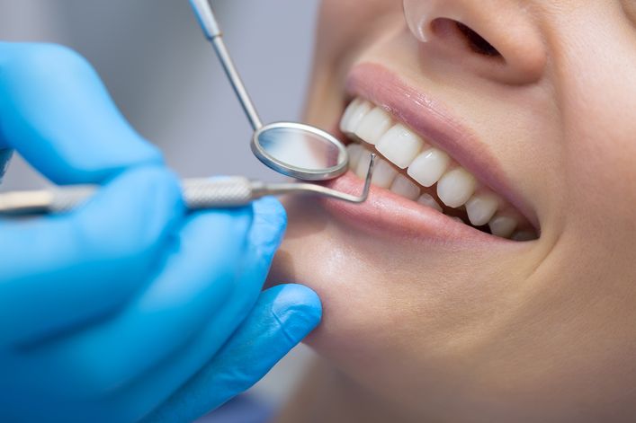 Bonding to metoda stosowana w ramach stomatologii estetycznej.