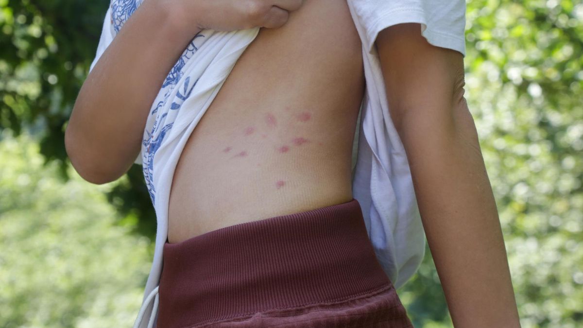 Odra w natarciu. Osiem razy więcej zakażeń niż rok temu