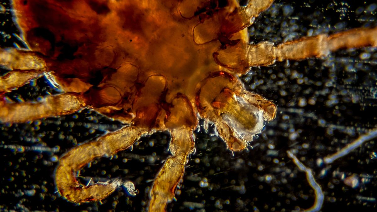 U pacjenta, którego ugryzł kleszcz, stwierdzono babeszjozę.