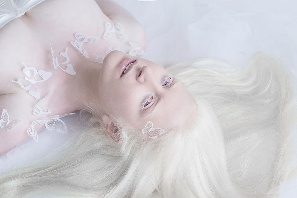 Julia Taits ujęła piękno alabastrowej cery ludzi z albinizmem w baśniowym projekcie