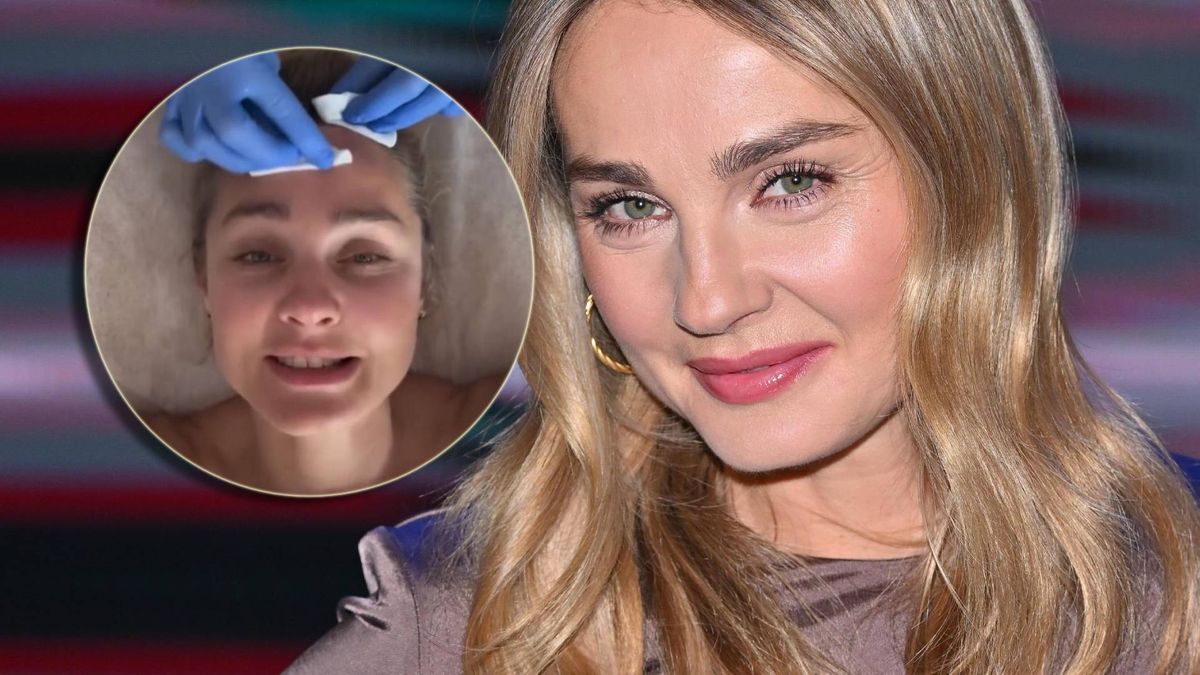 Małgorzata Socha korzysta ze specjalnej terapii