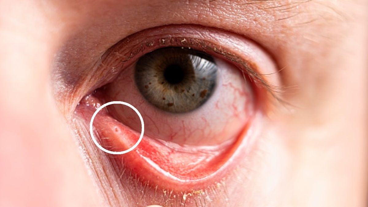 Wgłębienie pod okiem – do czego służy?