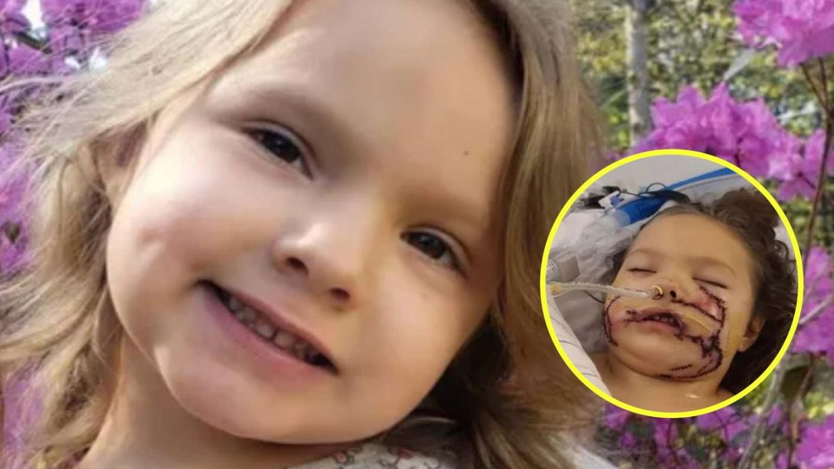 6-latkę zaatakował agresywny pitbull