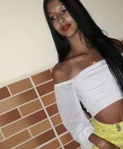 19-latka chciała się upiększyć. Coś poszło nie tak