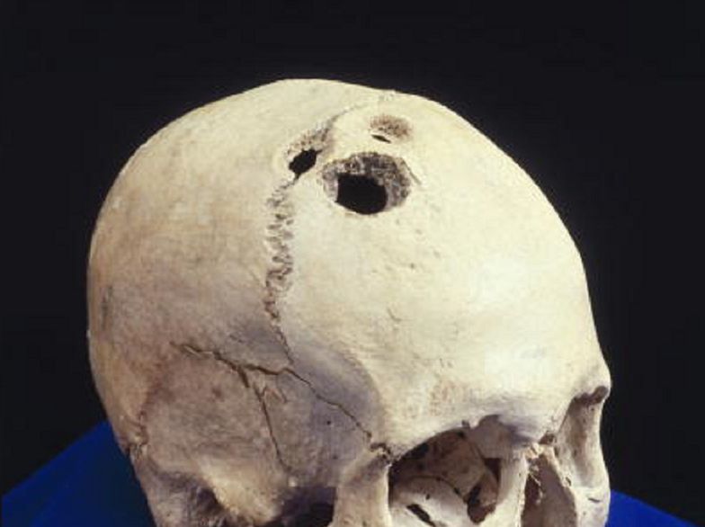 Znaleźli czaszkę z wielkimi otworami. Eksperci wyjawili prawdę
