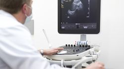 Zespół Schwartza-Jampela (SJS) - przyczyny, objawy, rozpoznanie, leczenie