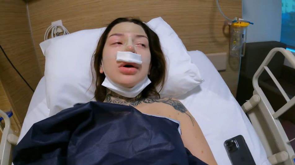 Marcysia Ryskala zrobiła operację nosa