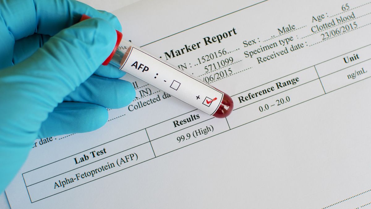 Oznaczanie AFP u kobiet ciężarnych jest wykorzystywane w diagnostyce wad cewy nerwowej u płodu lub wystąpienia zespołu Downa.