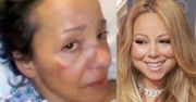 Siostra Mariah Carey: "UMIERAM! Potrzebuję Twojej pomocy!"