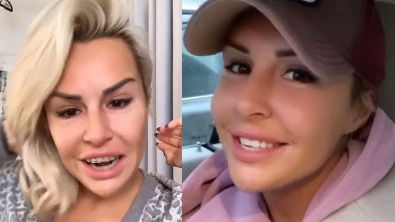 Blanka Lipińska zdjęła aparat i podcięła dziąsła