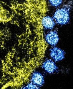 "Bardziej zakaźny i trudniejszy do zwalczenia". Wariant Lambda dotarł do Australii