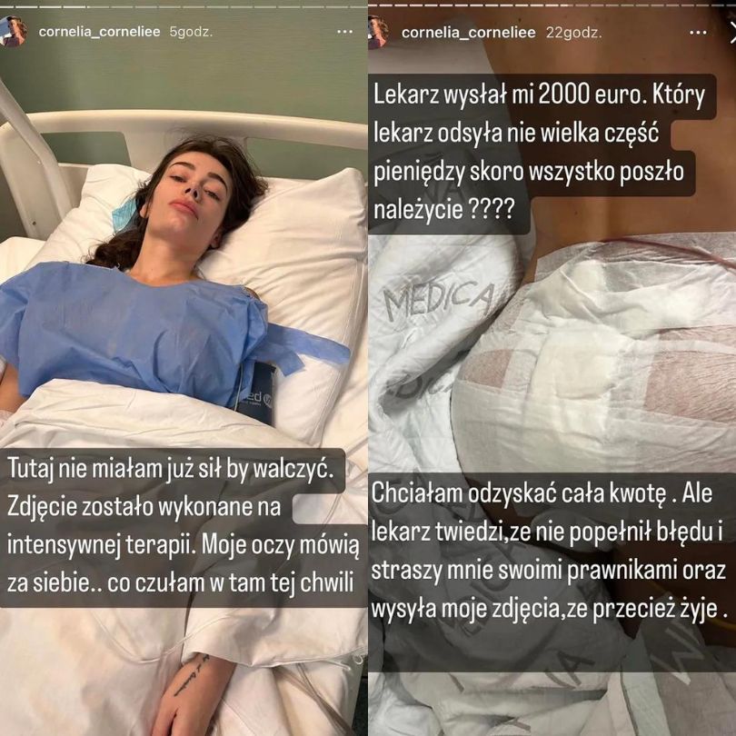 Polska influencerka wspomina horror po zabiegu w tureckiej klinice