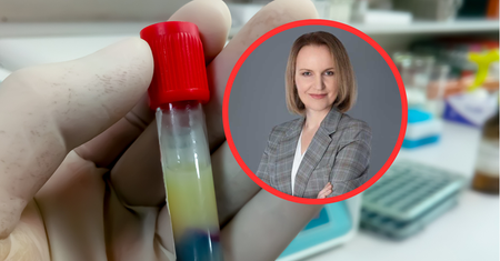 "Mądrzeją dopiero po zawale". Kardiolog mówi, jak zbić cholesterol