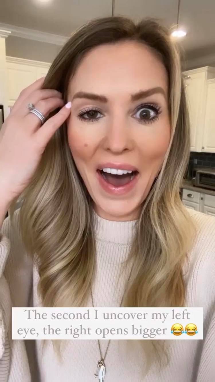 Whitney Buha po nieudanym botoksie