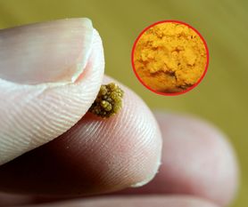 Cierpi ponad 3 miliony Polaków. Chorobę powodują popularne, pozornie zdrowe produkty