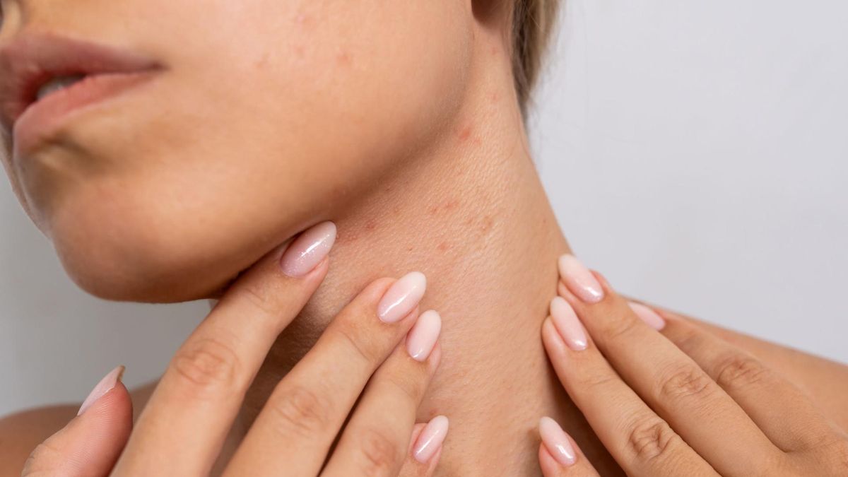 Wysypka może świadczyć o anemii